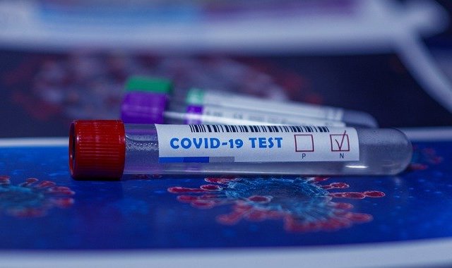 For COVID Tests, the Question of Who Pays Comes Down to Interpretation